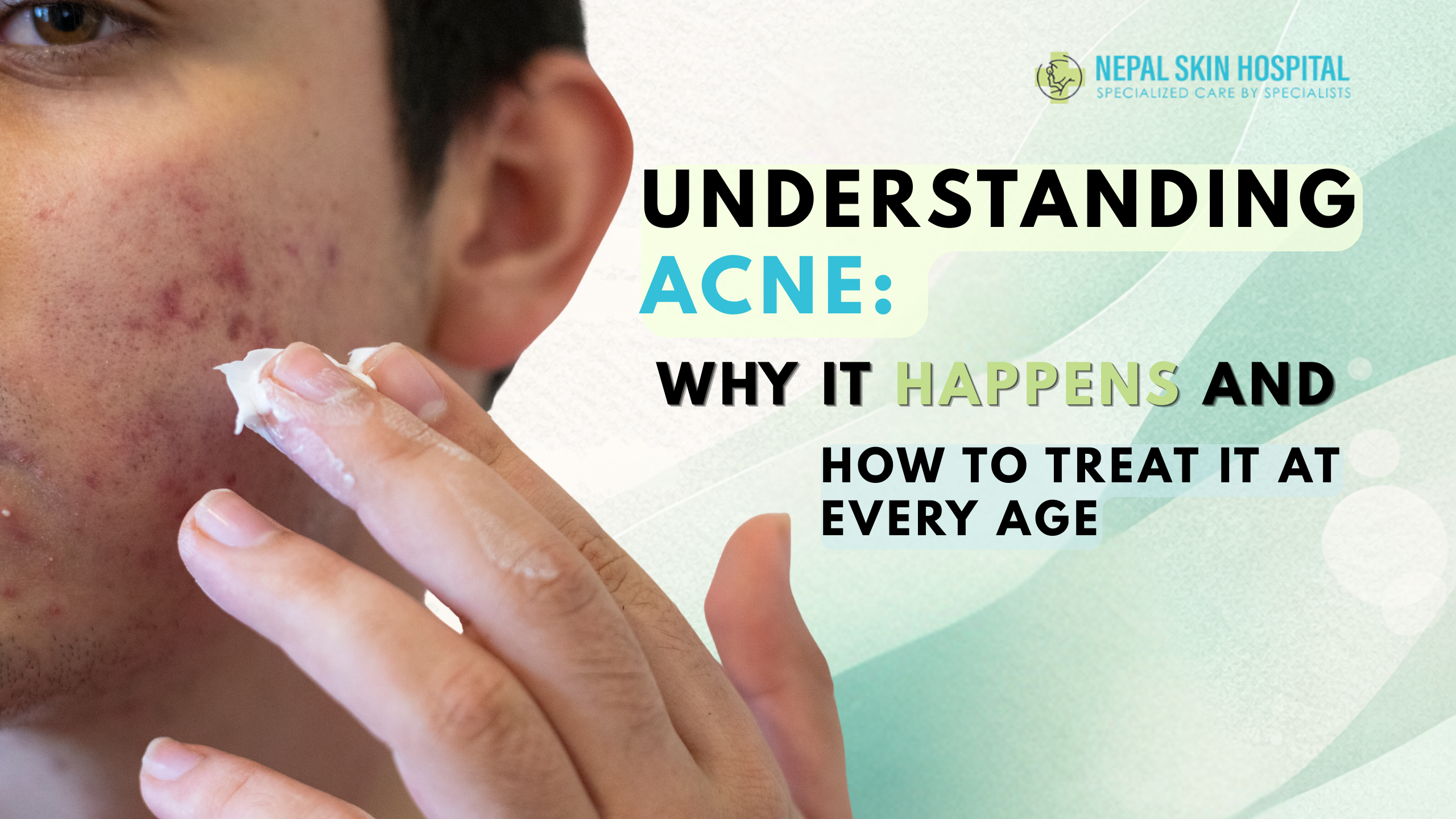 Understanding Acne: Why It Happens and How to Treat It at Every Age
