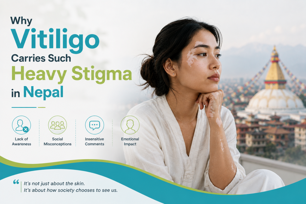 Why Vitiligo Carries Such Heavy Stigma in Nepal