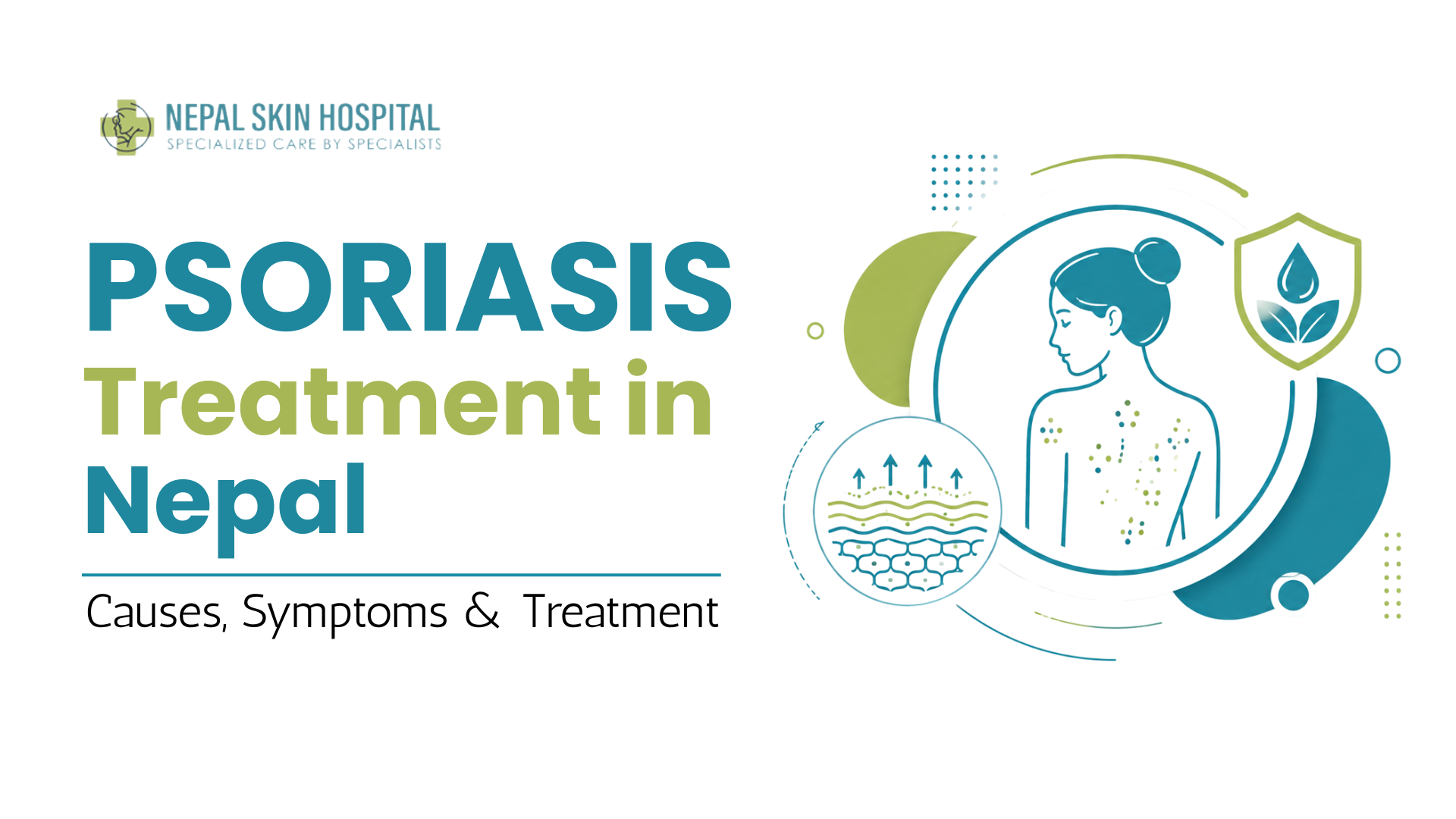 Psoriasis Treatment in Nepal: Causes, Symptoms, and What Actually Works