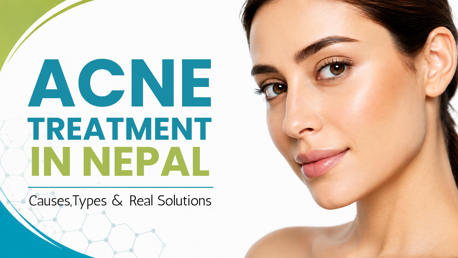 Acne Treatment in Nepal: Causes, Types & Real Solutions