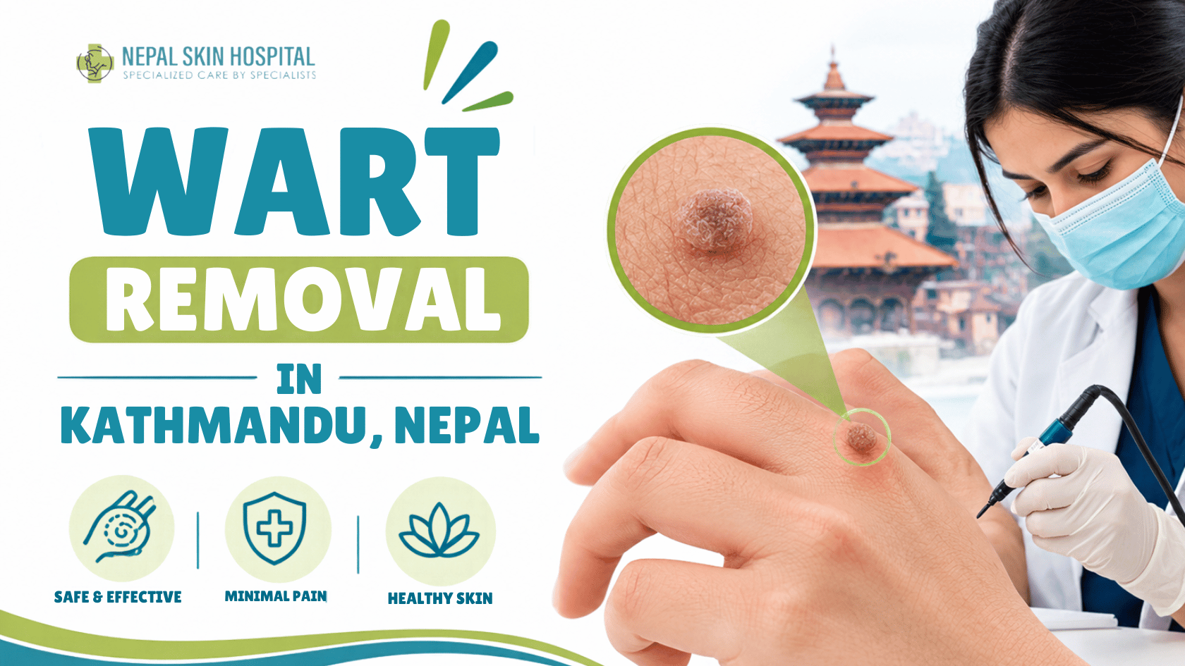 Wart Removal in Kathmandu, Nepal